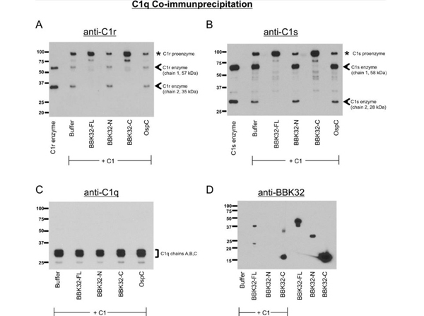 Immunoprecipitation using Goat TrueBlot® ULTRA: Anti-Goat IgG HRP